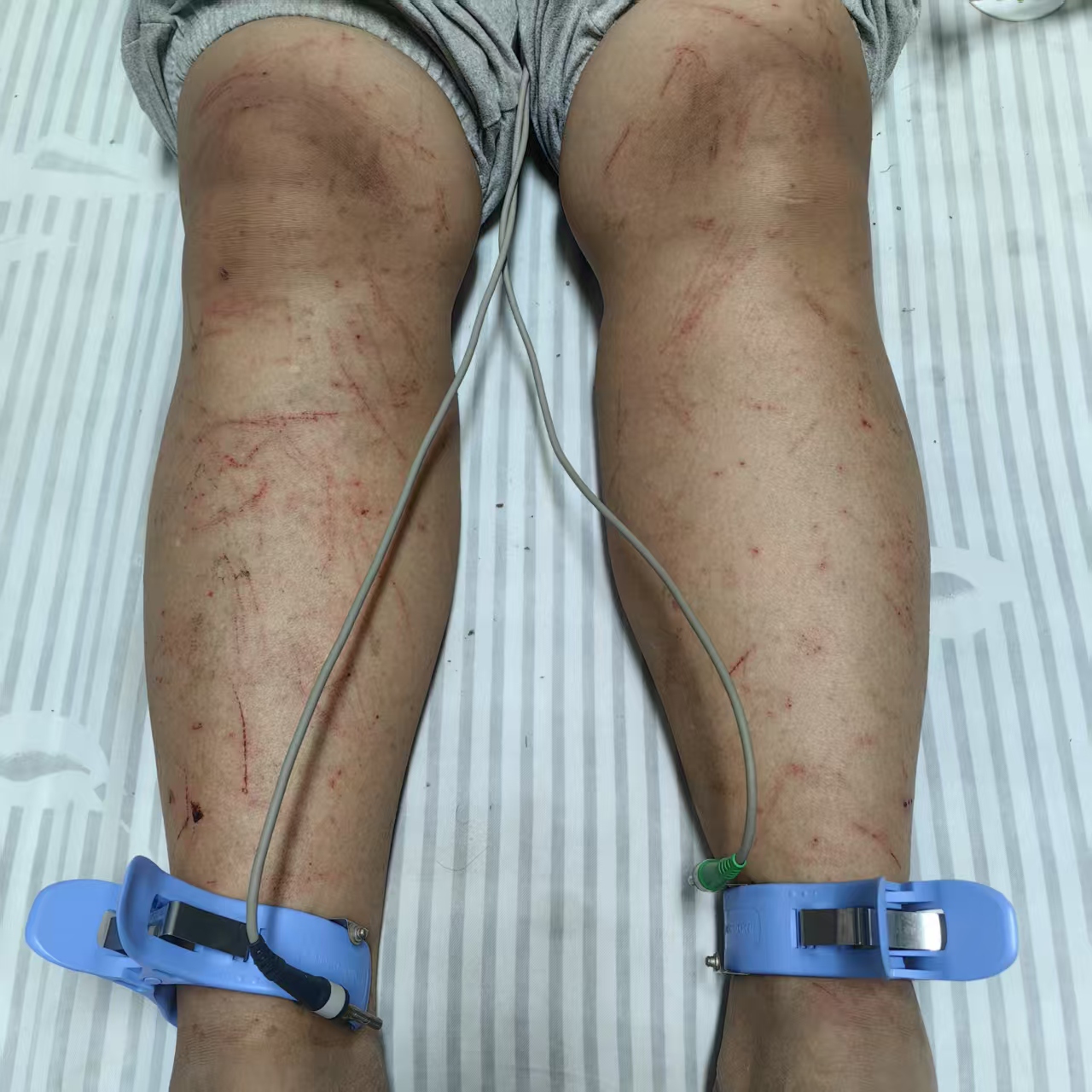 非法砍伐1.jpg