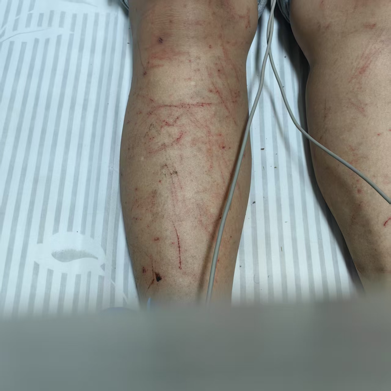 非法砍伐9.jpg